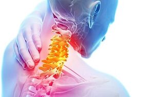 Symptoms of cervical osteochondrosis and food rules for the disease