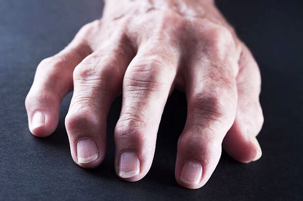 pain in the joints of the fingers