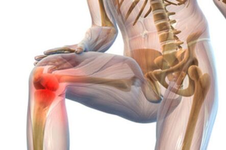 Pain in the knee joint with osteoarthritis