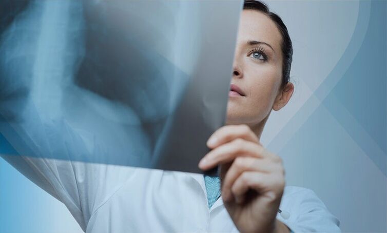 a doctor examines a photograph of the cervical spine with osteochondrosis